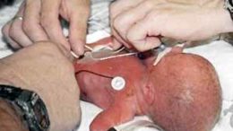 Premature-Birth-Rate