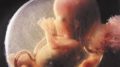 11-week-fetus-2
