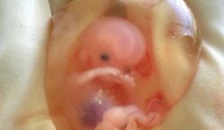 Abortion-250