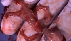 Abortion-Moral-Decline-300x225