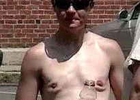 transgender_breasts_removed_boston