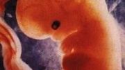 Unborn_Baby