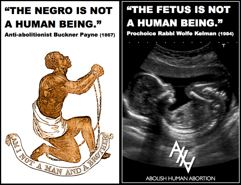 slavery abortion not human being