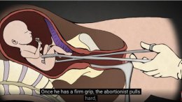 15 weeks gestation