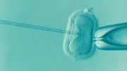 IVF ethical concerns
